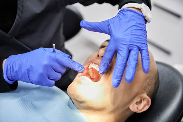 Best Urgent Tooth Repair  in Mccla, AL